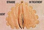 Strasse + In Treatment/ EXIL# 13_Resurgent